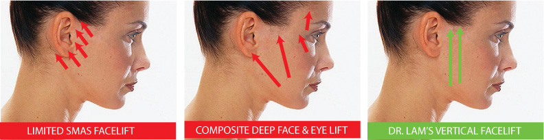 Facial plastic surgeon dallas hot babe