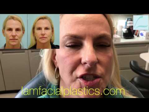 Botox & Fillers Testimonial Immediately Following Treatment in Dallas, TX