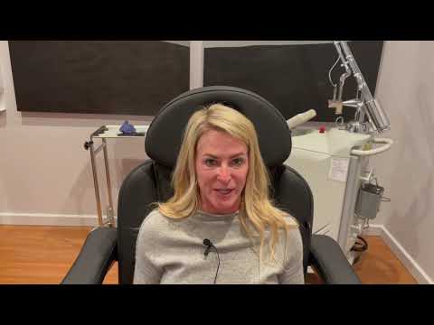 Dallas Facelift and Fillers Testimonial with Photos