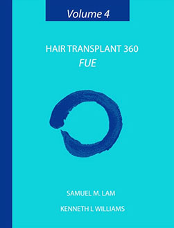 Hair Transplant 360