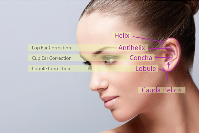 Otoplasty Dallas