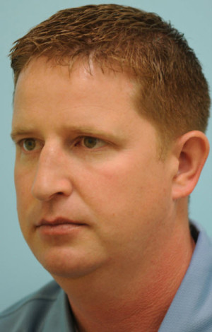 Chin Augmentation