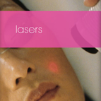 Image of a Laser Services patient