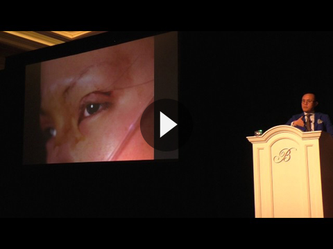 Asian Cosmetic Surgery Videos