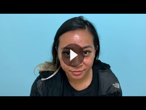 Asian Cosmetic Surgery Videos
