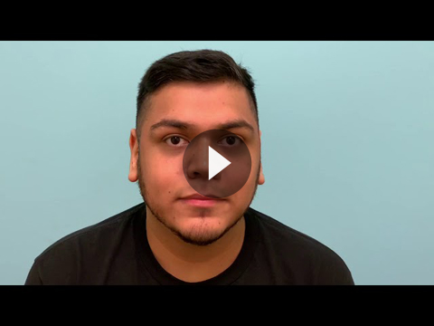 Nasal Tip Rhinoplasty Videos