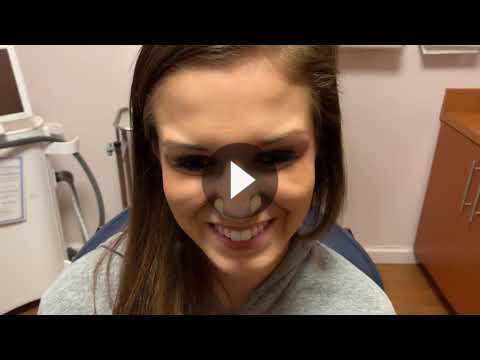 Botox for Migraines Videos