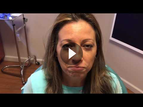 Botox for Gummy Smile Videos