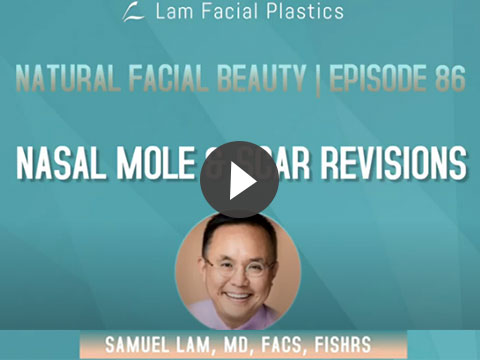 Nasal Mole & Scar Revisions