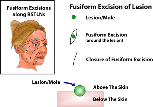 fusiform fusiform