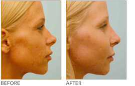 revision_nose_job