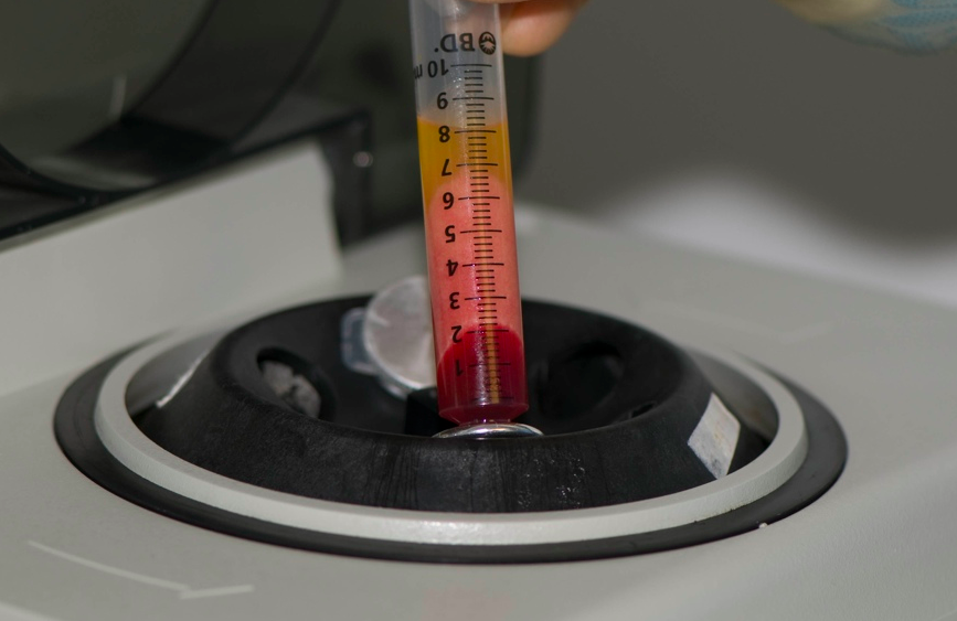 fat-grafting-processing