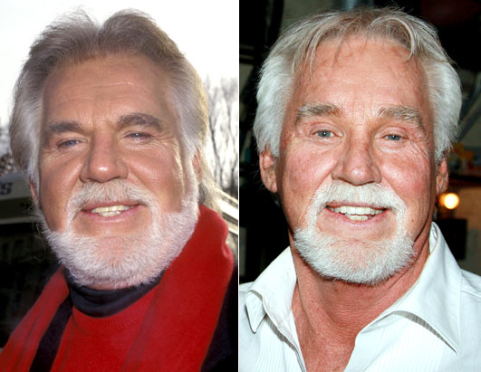 kenny rogers plastic surgery