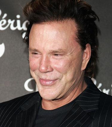Mickey Rourke Plastic Surgery